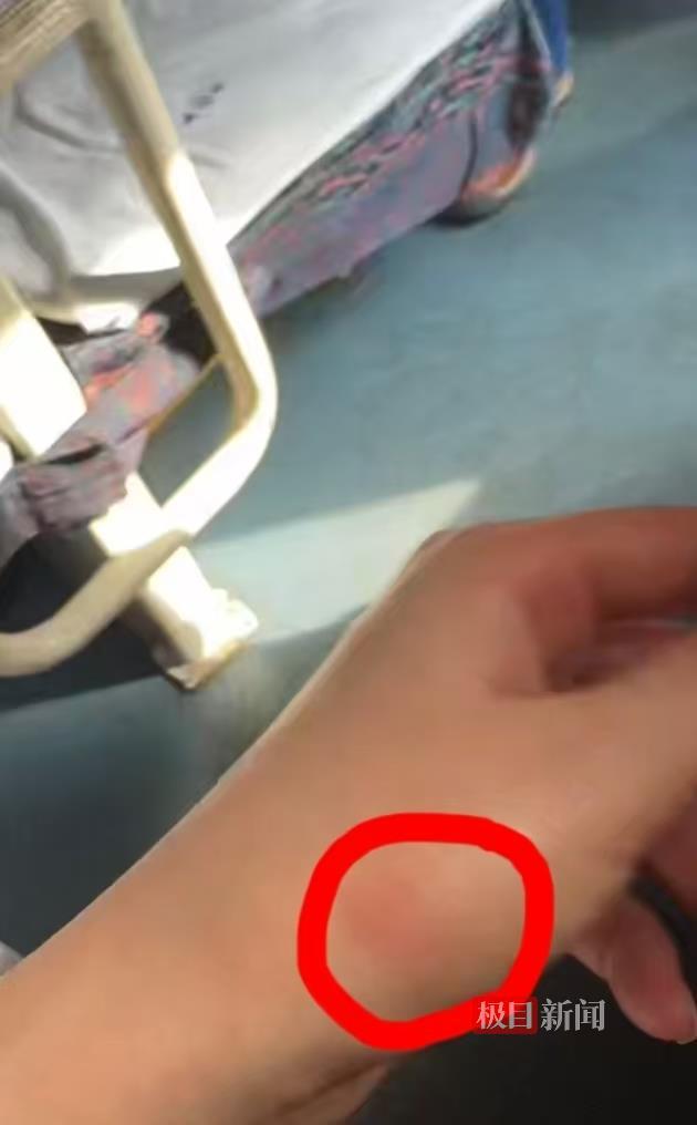 女子称坐火车硬卧遭虫咬 双方各执一词引发热议