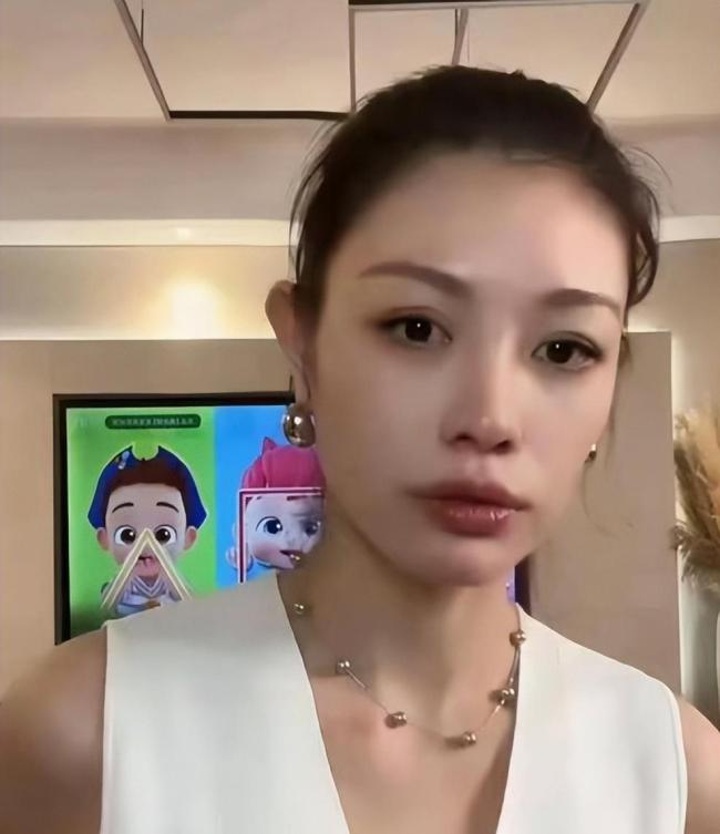 汪峰前妻自曝被男友暴打 已宣布分手 直播揭露家暴真相