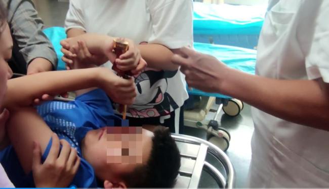 “网红蝴蝶刀”暗藏风险 安全隐患需警惕