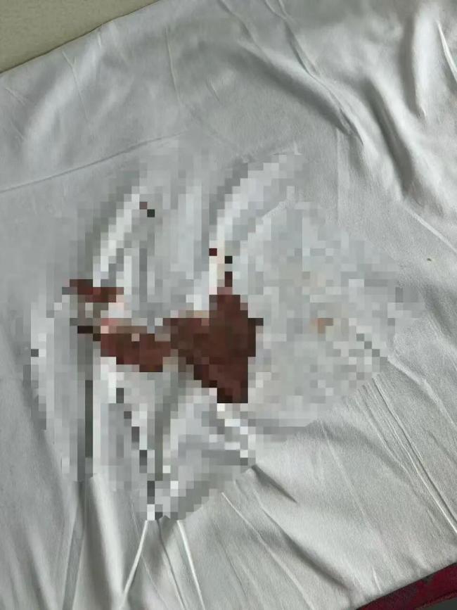 女子月经弄脏火车卧铺被要求赔钱 呼吁列车售卖卫生巾