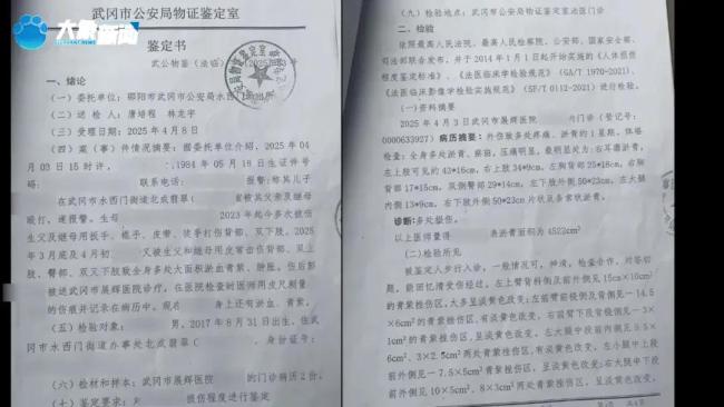 湖南姐弟俩遭继母生父虐待长达5年 满身伤痕触目惊心