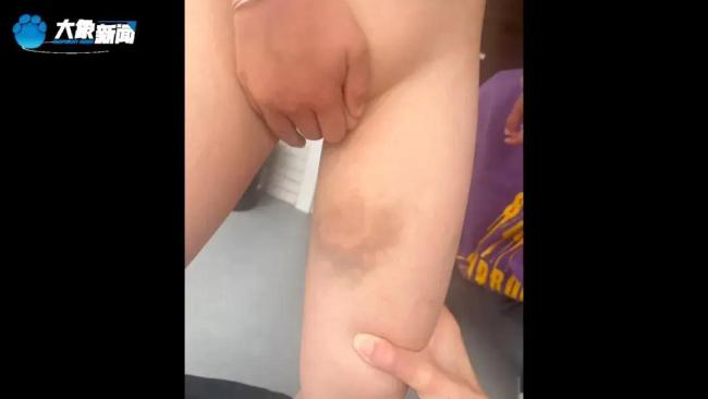 湖南姐弟遭继母生父刻毒细节曝光 狂暴活动令东谈主发指