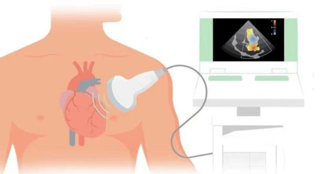 体检正常不等于运动安全 马拉松猝死引发的思考