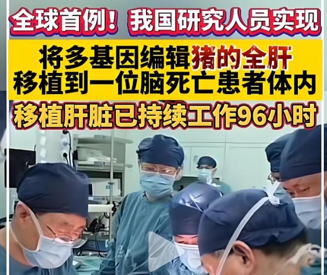 异体移植突破跨物种器官移植壁 医学革命带来新希望