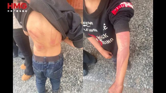 15岁姐姐目睹弟弟被继母虐待全程 生父继母的残忍行径