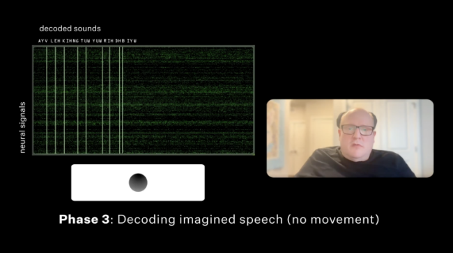 马斯克脑际芯片让失语者开口 大脑信号转语音