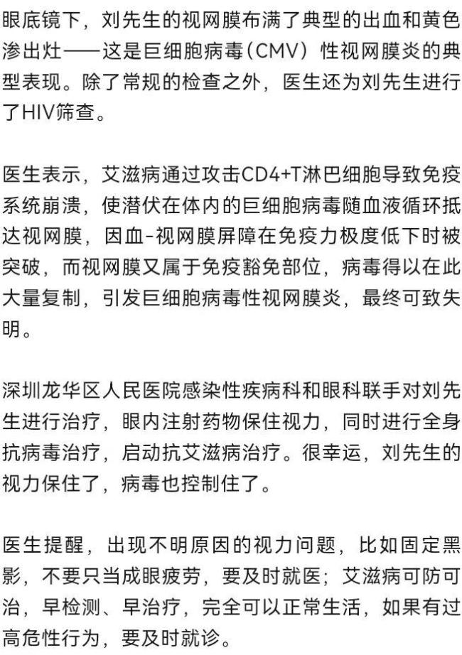 男子眼睛模糊查眼科竟查出艾滋病