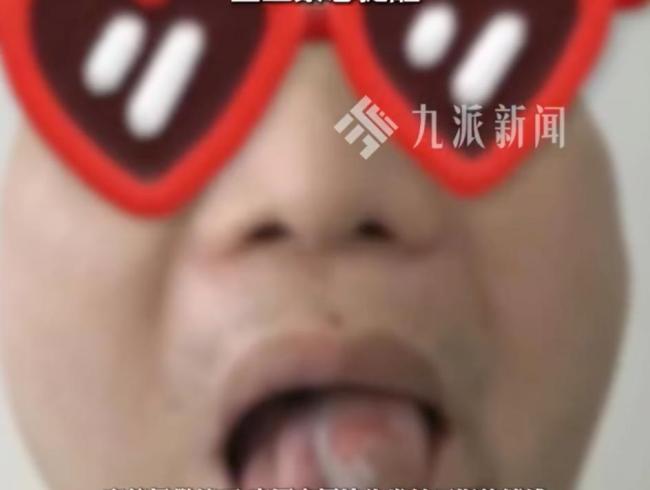 男子舌头长疙瘩以为上火结果是舌癌