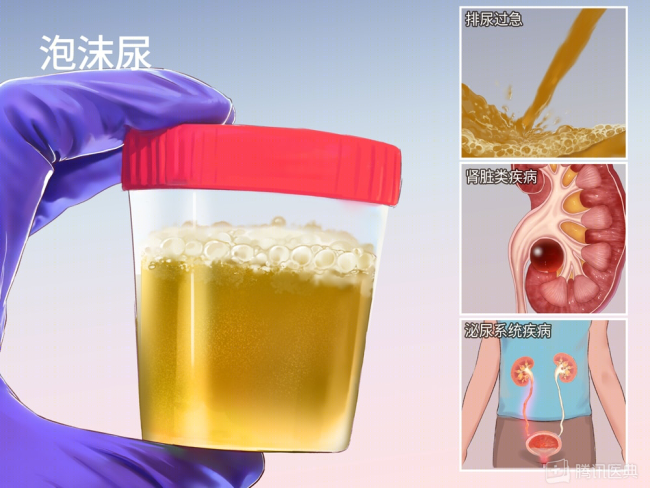 小伙乱吃药致双肾报废终身透析 药物滥用的沉重代价