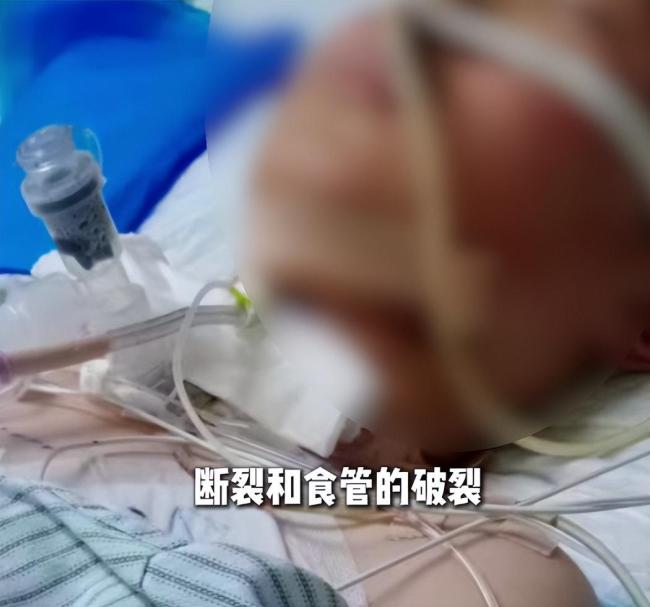河南沁阳男孩骑车遭绳索割喉