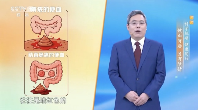 我国结直肠癌发病率居恶性肿瘤第2位