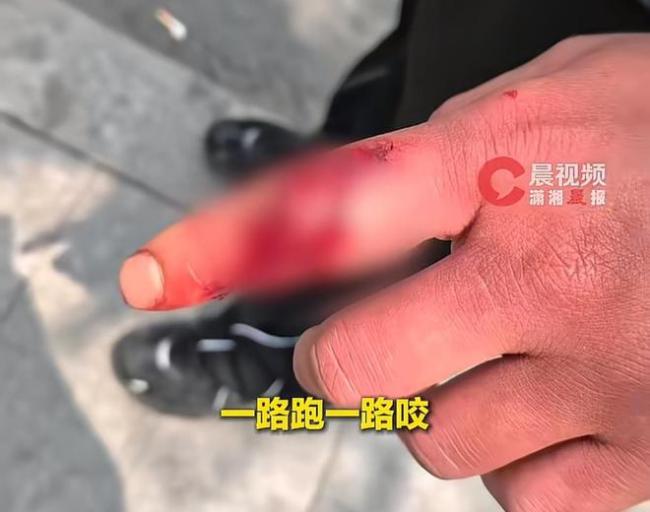 杭州一恶犬无差别咬人 7人受伤引发恐慌