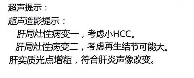 男子肝癌诊断存争议 卫健委介入