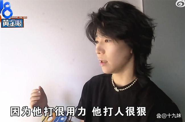 姑娘称火锅店里起纠纷后被打断两颗门牙 无妄之灾引发热议