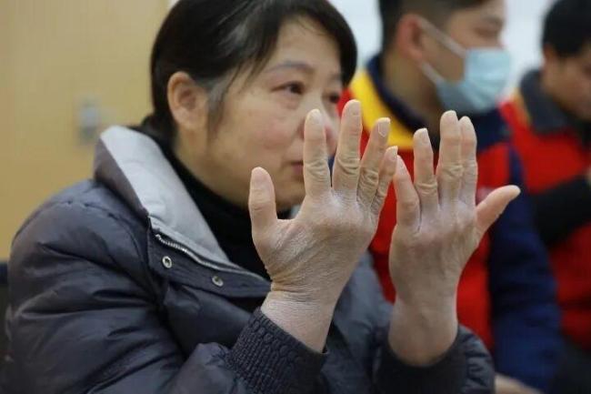 罕见病孩子母亲用12小时写感谢信 感恩医者仁心