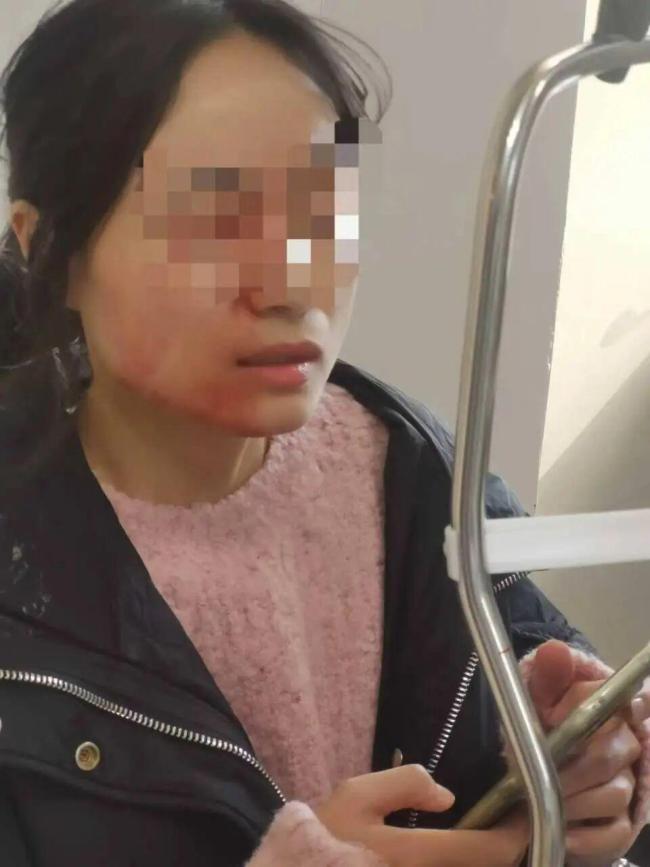 老师劝架被学生戳伤眼球 学校通报 教师已接受二次手术