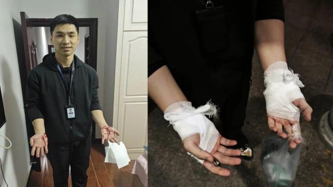 幸好沒扎臉上 不然婚都結(jié)不了了：民警勇擒嫌犯負(fù)傷