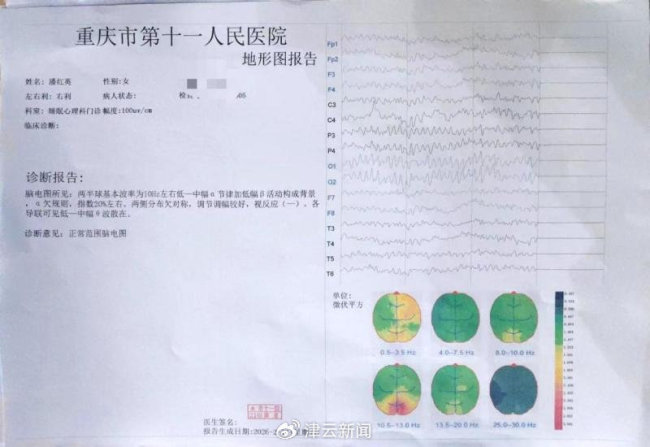 向精神醫(yī)生訴苦卻被強制收治161天 女子司法鑒定難摘帽