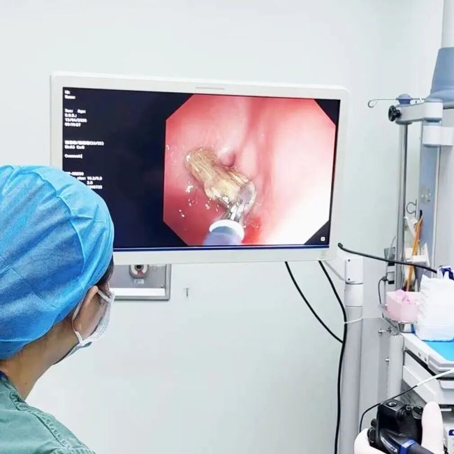 女子不慎吞下枣核腹痛难忍 医生:这个坏习惯很多人都有