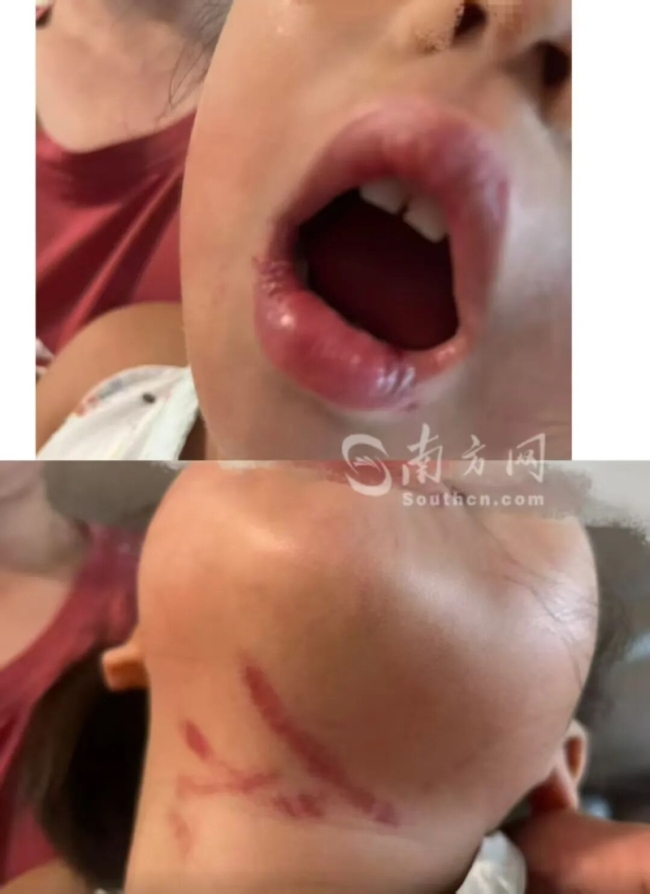 警方介入3岁女童遭幼师暴力喂食 涉事老师被依法拘留