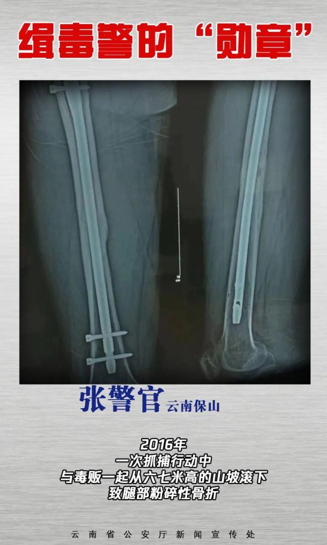 媒体：缉毒警察的伤疤是摘不掉的勋章 无言荣光