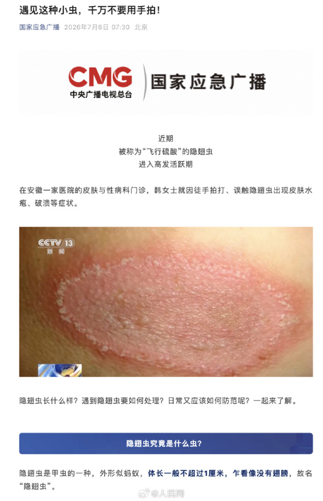 注意！遇见隐翅虫不要用手拍 如何避免被隐翅虫盯上