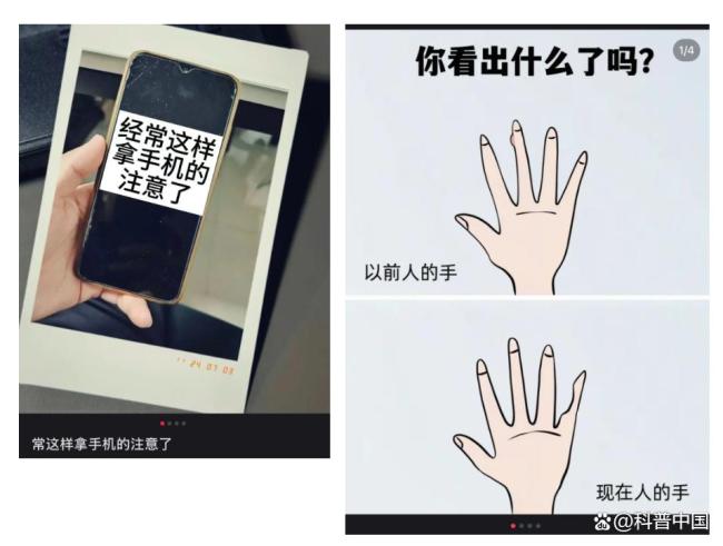 用小拇指做手机支架的受害者出现了
