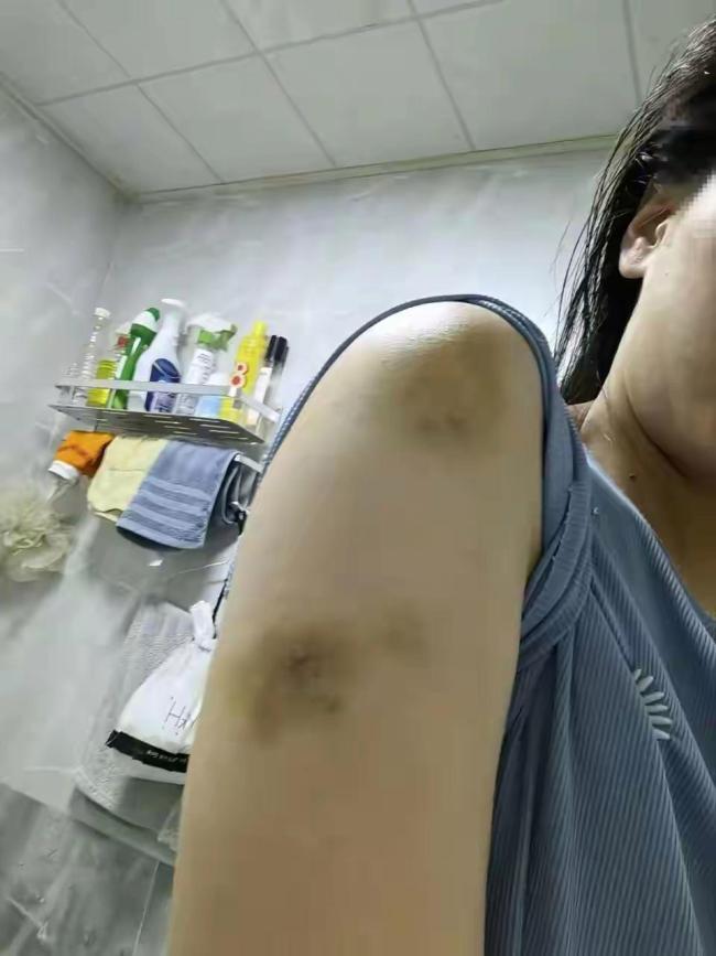 女子生前遭男友长期家暴找父亲哭诉 悲剧背后的坚决诉求