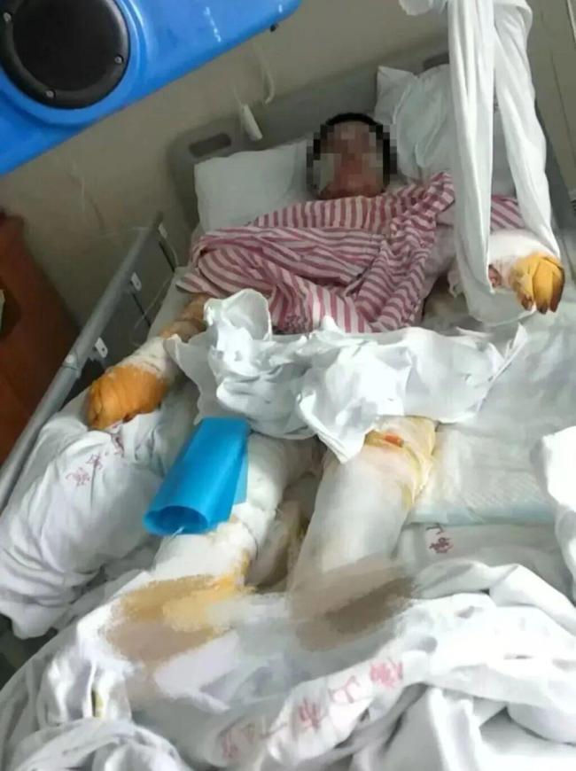 男子求爱遭拒泼硫酸捅刺被执行死刑 罪有应得