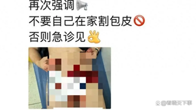 小伙自割包皮或致功能障碍