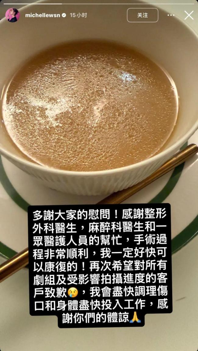 金像奖影后卫诗雅受伤缝50多针 片场意外引关注