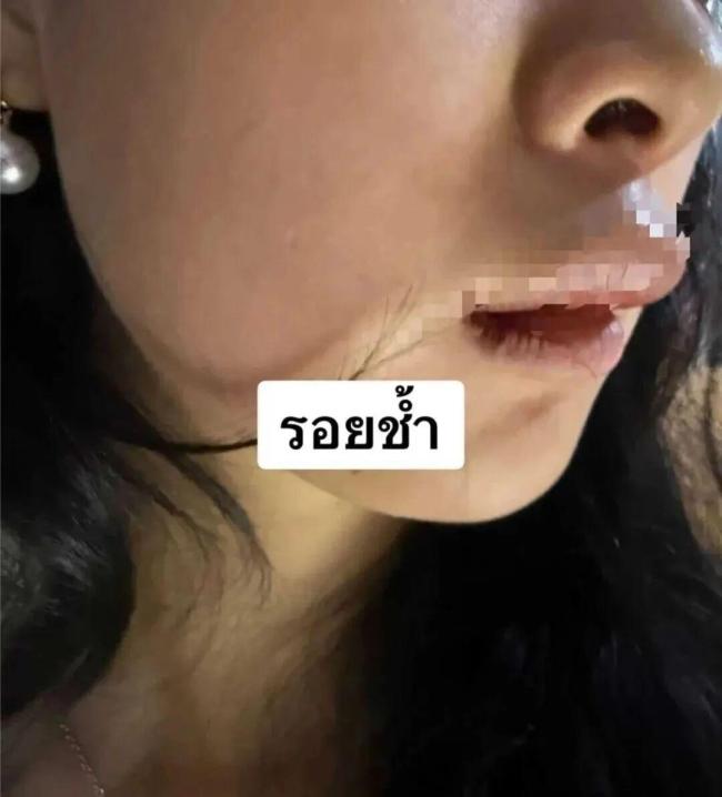 中国女子泰国遭绑架后逃脱 警方逮捕四名嫌疑人