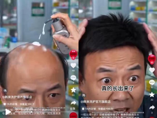 7天长不出头发赔1万元？洗发水被投诉
