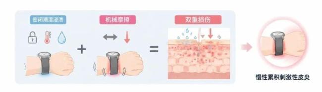 智能手表还能不能放心戴 了解皮肤损伤真因