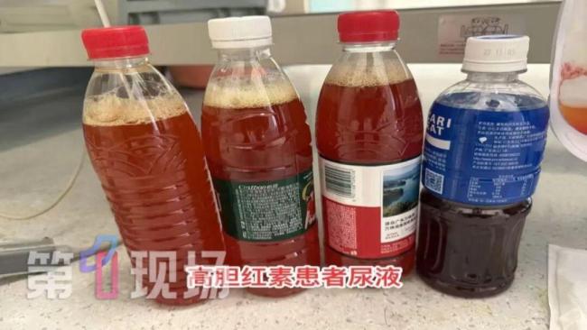 男子手术切除五个器官“保命”