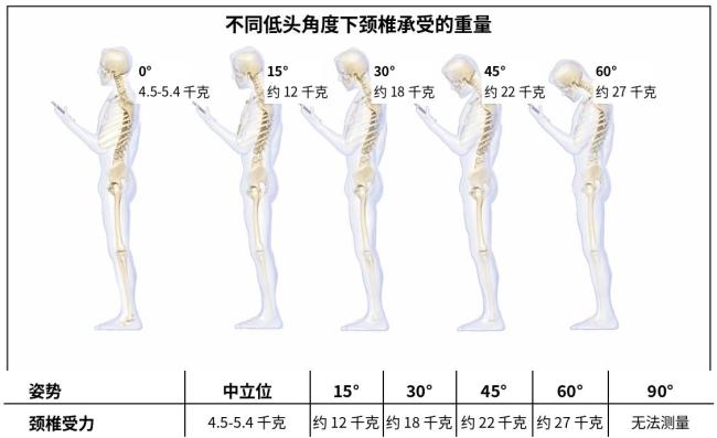 这么刷手机 脖子要扛不住了 颈椎承受极限负荷