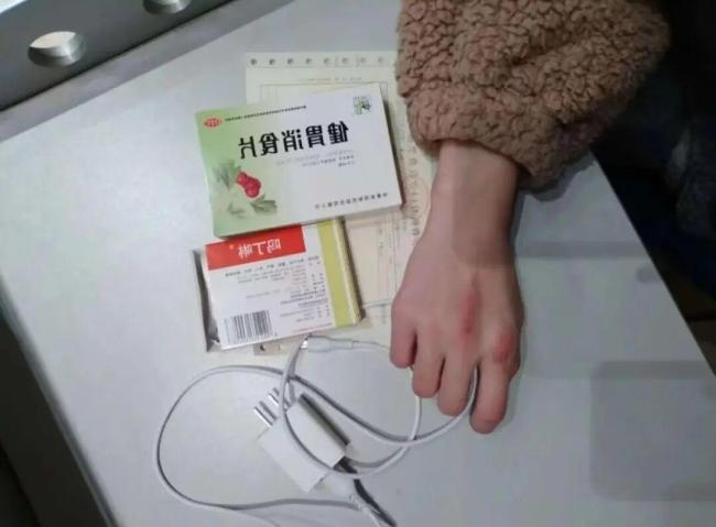 吃播女网红去世前多次展示手背上的针眼 暴食症下的悲剧