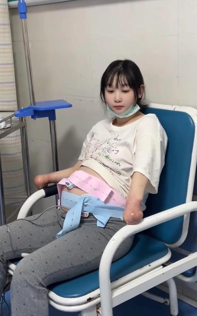 女子3岁烧掉双手现孕珠9个月遭质疑 丈夫回怼恶评
