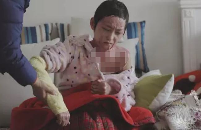 16岁少女被官二代毁容 父亲钉死窗户：怕他出狱来报复