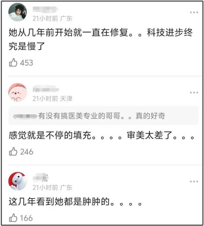 韩星林娜琏脸部肿胀变气球，韩式审美太糟糕，大批偶像都撑不住了