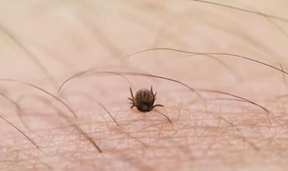女子被蜱虫咬后发病到死亡仅7天 户外活动需警惕蜱虫隐患