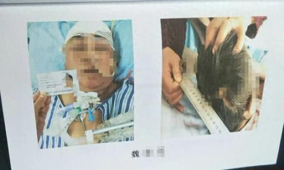 目睹母亲过马路被车撞，27岁女子受惊吓5天后身亡 家庭悲剧引发赔偿难题