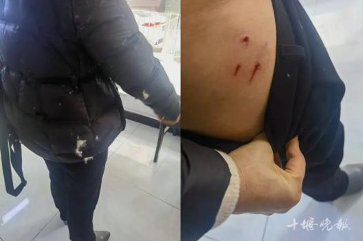 流浪猫8天抓咬3名路人投喂者被起诉 投喂者成被告