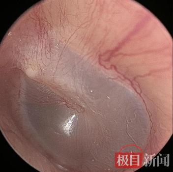 男子和貓同睡耳中長(zhǎng)出貓螨蟲(chóng) 寵物共眠需謹(jǐn)慎