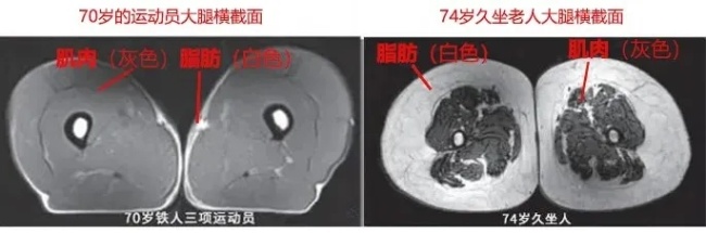運動是加速衰老還是延緩衰老 真相揭曉