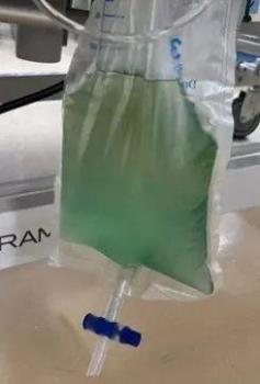 小伙亞硝酸鹽中毒尿液呈藍(lán)色 緊急救治挽回生命