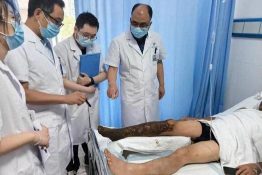 市中心醫(yī)院已收治20余例,！緊急擴(kuò)散,！科學(xué)急救指南 夏日蛇患應(yīng)對(duì)策略
