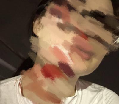 女子在成都綠道騎行被魚線絆倒 安全隱患引關(guān)注