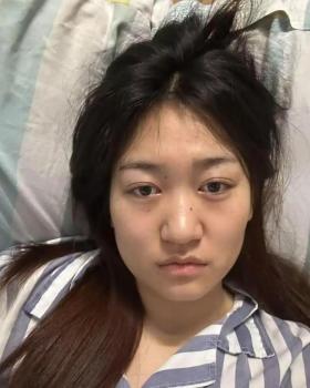 公厕被打女孩家庭已无力承担医疗费 急盼社会援助