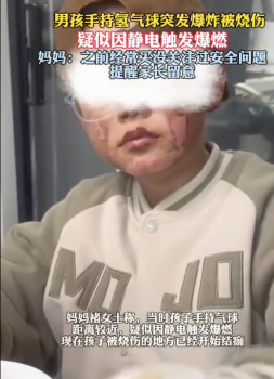 氫氣球爆燃致男孩手臉和耳朵燒傷！